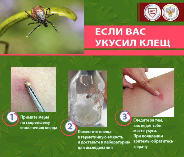 ОСТОРОЖНО! КЛЕЩИ! ОСТОРОЖНО! КЛЕЩИ!.